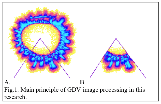 GDV APPLICATION IN ONCOLOGY