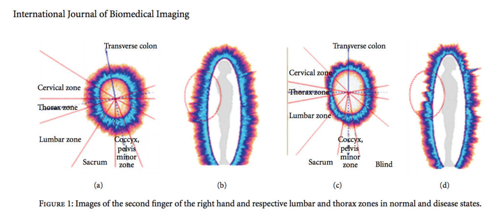 Gas Discharge Visualization: An Imaging and Modeling Tool for Medical Biometrics