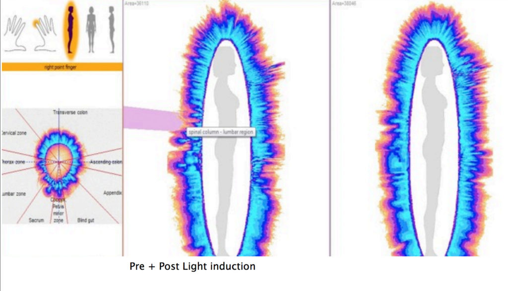 What is Electro Photon Imaging