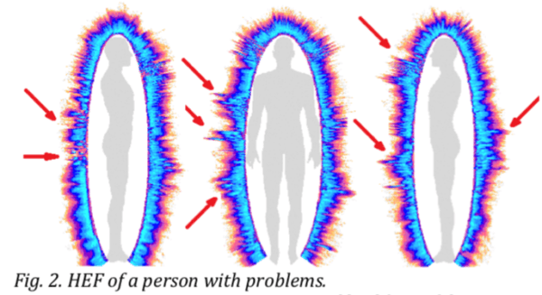 Measuring Human Energy Field