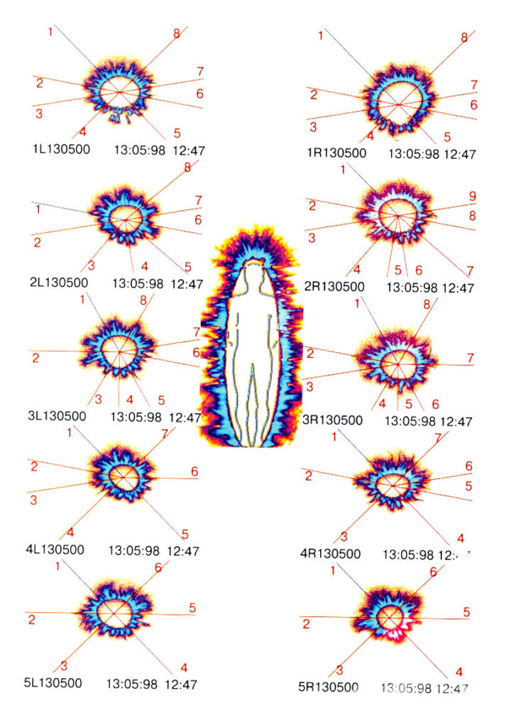 SCIENTIFIC ANALYSIS OF THE HUMAN AURA