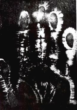 1892 Bioelectrography