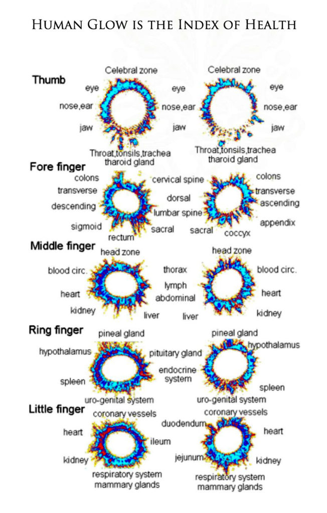 GDV chart, Korotkov's images