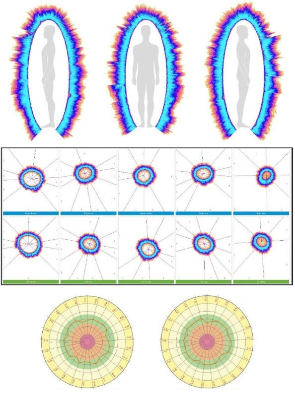 GDV Diagnosis Chart, GDV Maps, GDV Tables