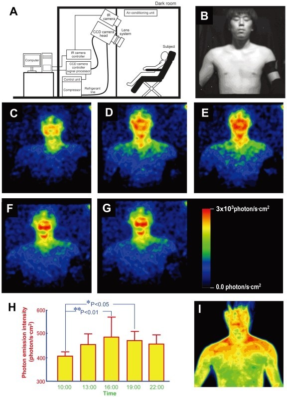 Imaging of Ultraweak Spontaneous Photon Emission from Human Body Displaying Diurnal Rhythm